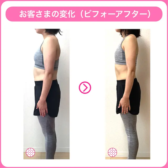 二の腕痩せに成功したお客様のビフォーアフター画像2