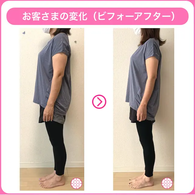 骨格ストレートタイプの女性が二の腕痩せに成功したビフォーアフター画像3