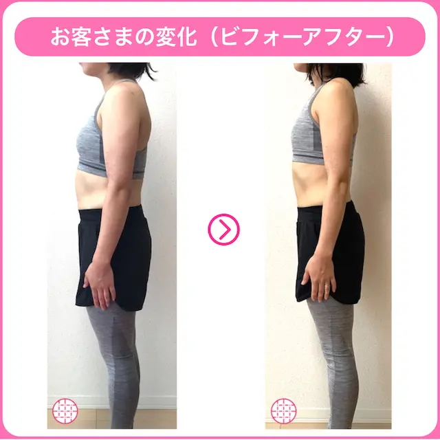 骨格ストレートタイプの女性が二の腕痩せに成功したビフォーアフター画像2