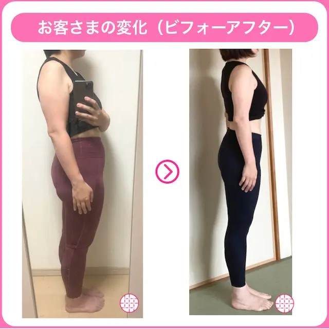 骨格ストレートタイプの女性が二の腕痩せに成功したビフォーアフター画像1