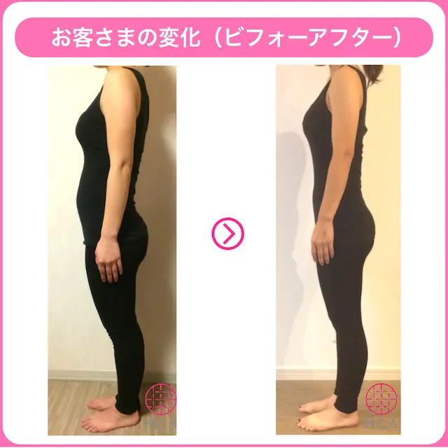 二の腕痩せに成功したお客様のビフォーアフター画像3