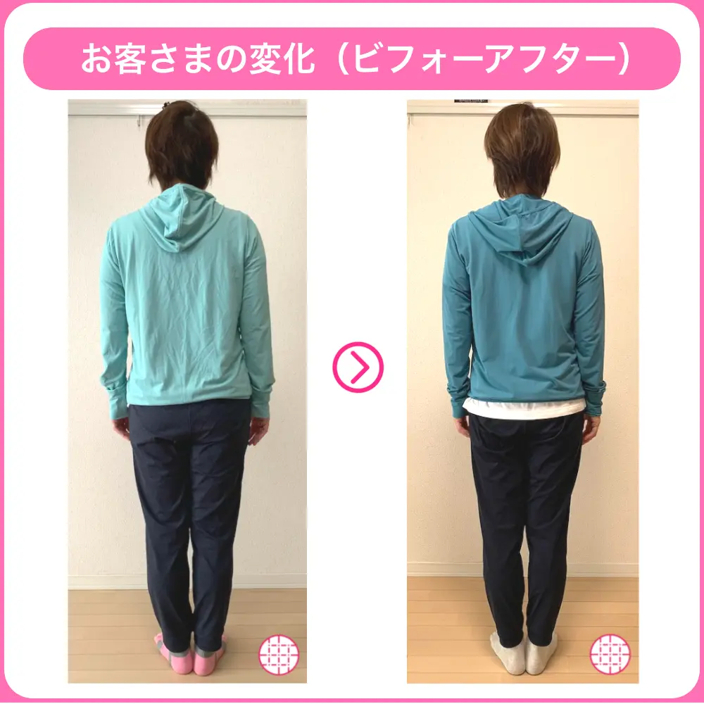 骨格ナチュラルタイプで太ももが太いとお悩みの女性(46歳・F様)のビフォアーアフター画像