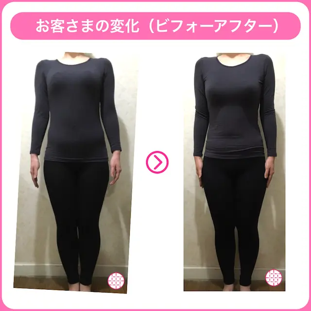 骨格ナチュラルタイプで太もも痩せに成功した女性（僕のジムのお客様）のビフォーアフター画像１ N様